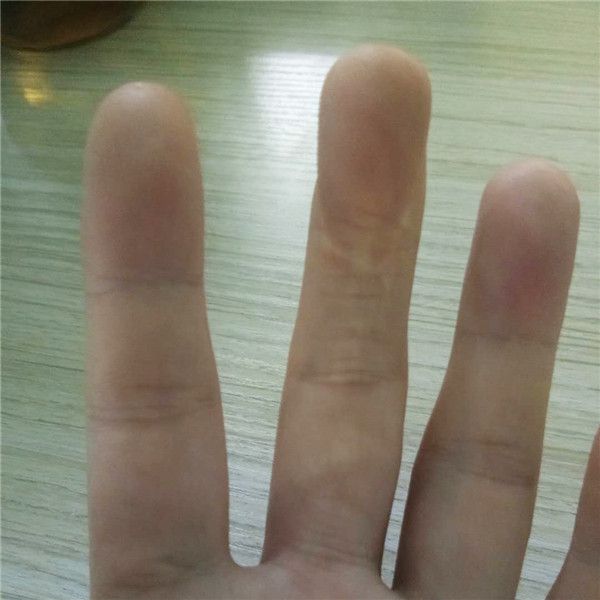 502膠水把手黏住了怎么辦